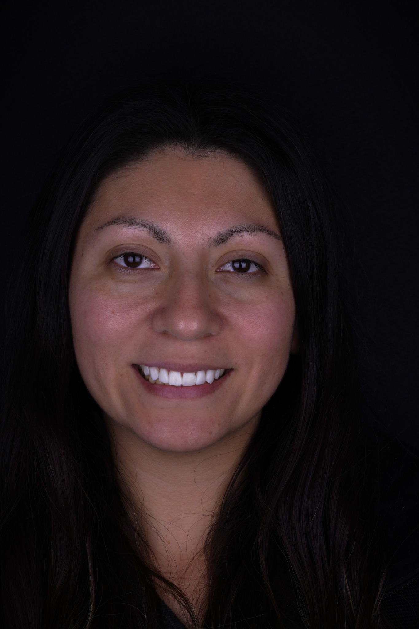 After smile transformation