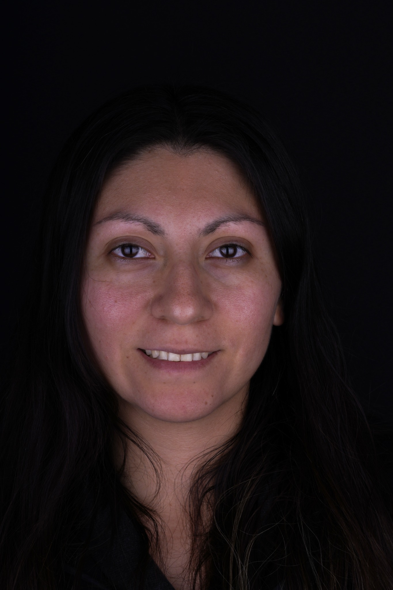 Before smile transformation